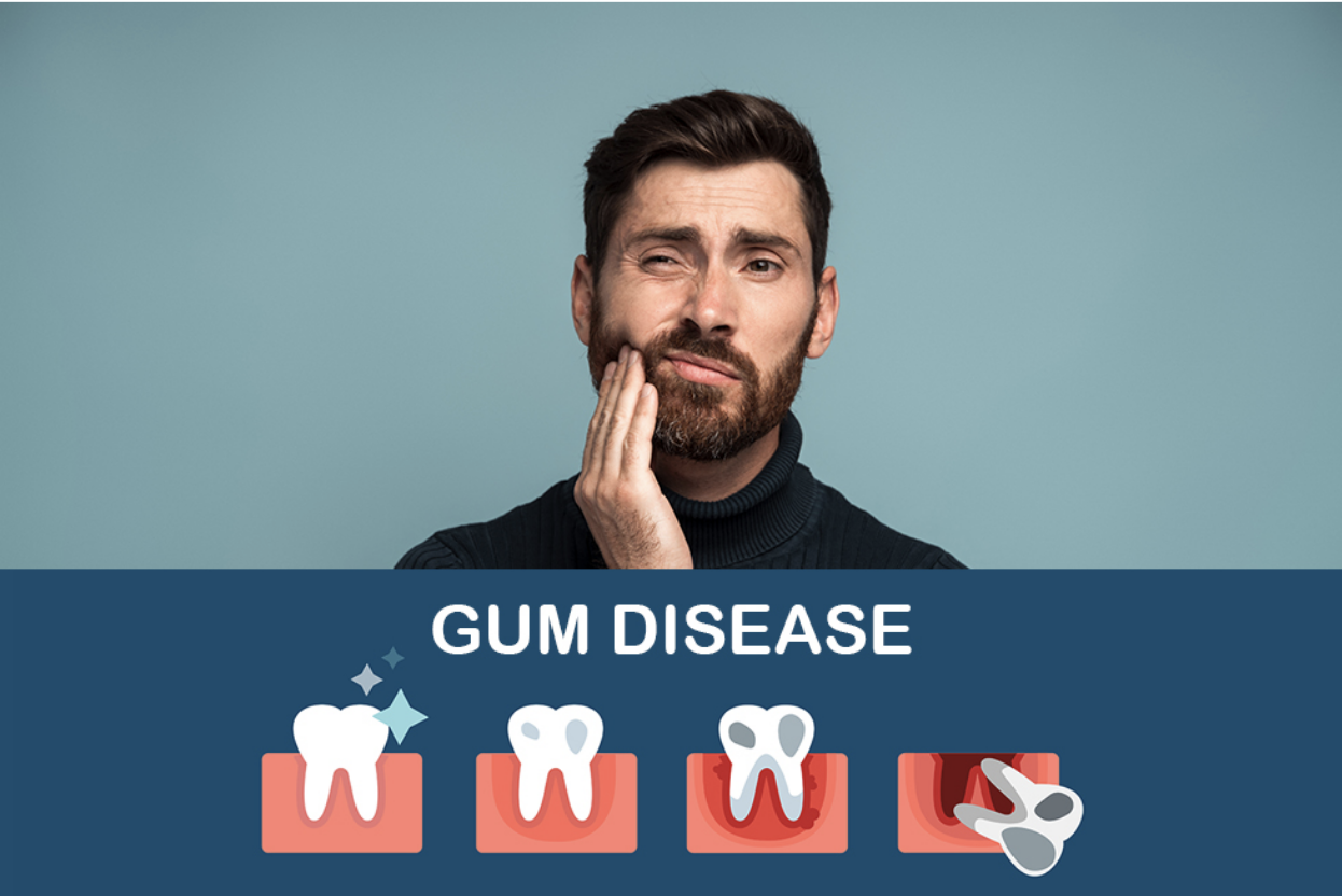 Gum Disease Can Give You a Heart Attack!